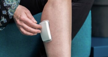 Relegs: oplossing voor onrustige benen geboren uit eigen frustratie